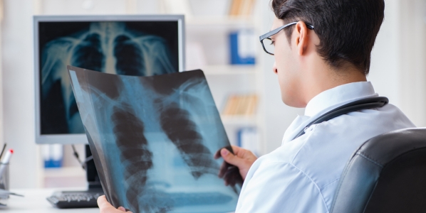 Health professional examining a lung x-ray