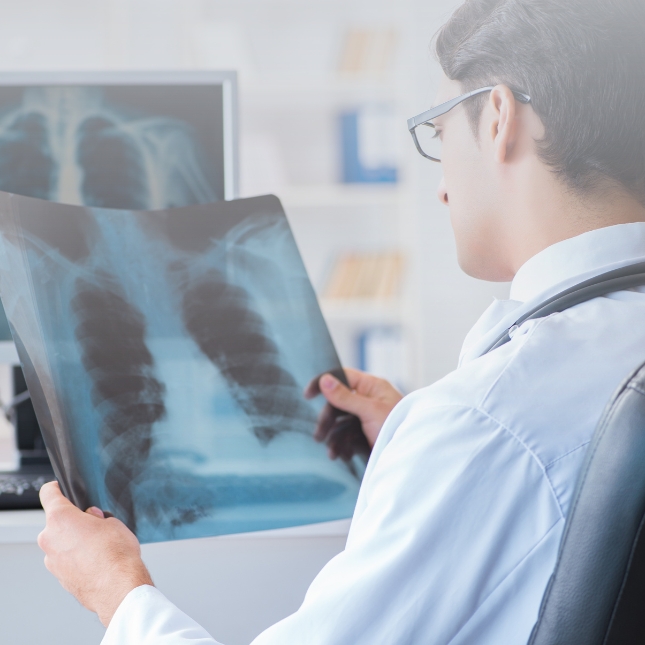 Health professional examining a lung x-ray